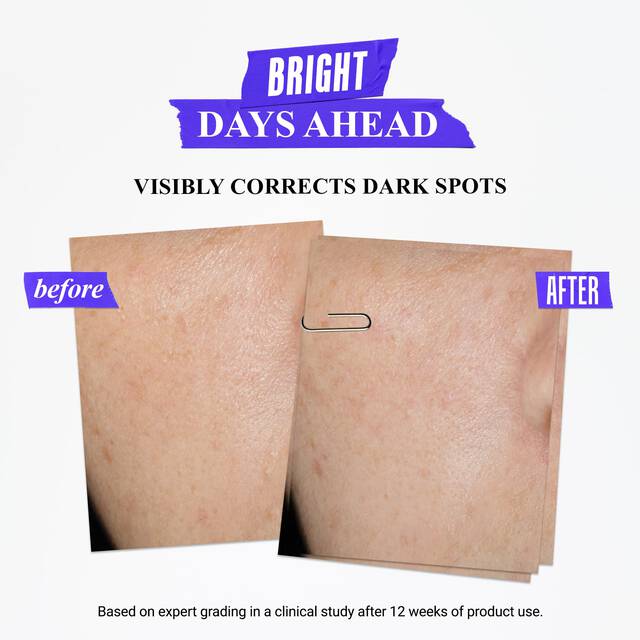 سيروم كليرلي كوريكتيف لتصحيح البقع الداكنة